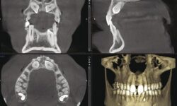 What is Cone Beam (CT)?